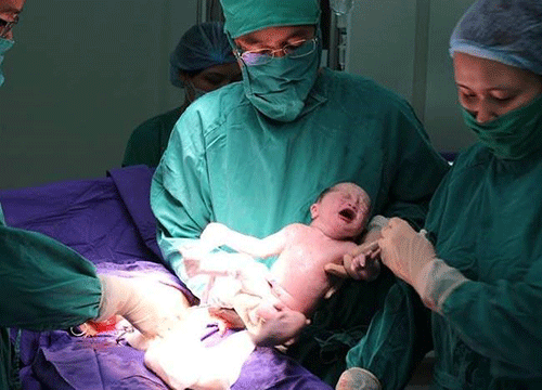 Em bé chào đời sau ca phẫu thuật sinh đôi kéo dài nhiều giờ đồng hồ