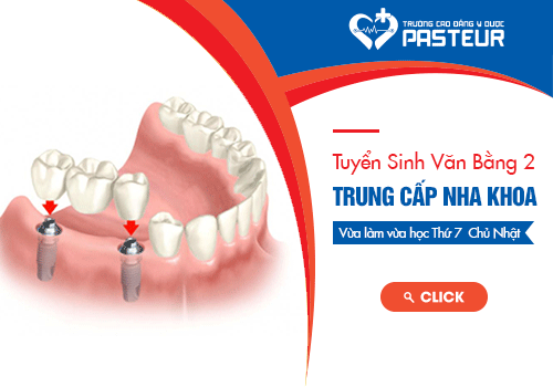 Tuyển sinh Văn bằng 2 Trung cấp Kỹ thuật phục hình răng Hà Nội năm 2018