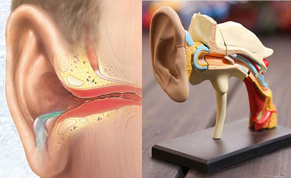 Tìm hiểu nguyên nhân và phương pháp điều trị bệnh viêm tai giữa