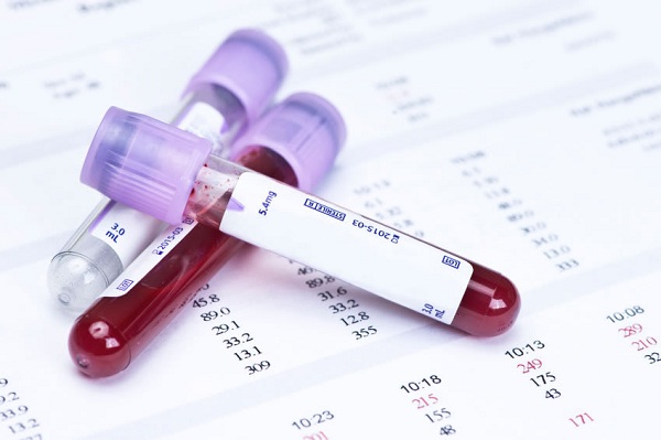 Tìm hiểu ý nghĩa của các chỉ số xét nghiệm sinh hóa máu - 2